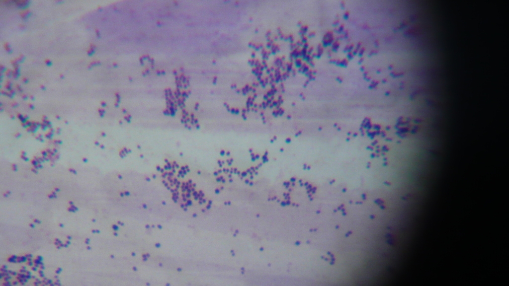 staphylococcus aureus gram stain. gram stain 보라색으로 나타남.